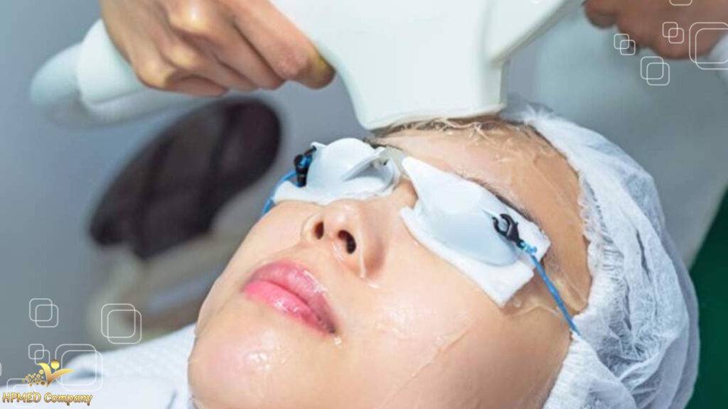 So sánh công nghệ triệt lông Diode Laser và DPL 9 so sanh cong nghe triet long diode laser va dpl