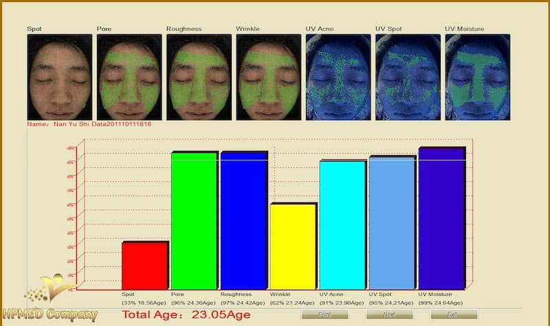 Hướng Dẫn Đọc Chỉ Số Máy Soi Da Chuyên Nghiệp Cho Spa 4 cach doc ket qua may soi da 3