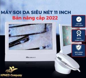 may soi hinh anh da bi nhiem corticoid 2