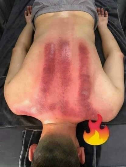 Máy Đả Thông Kinh Lạc 2 MÁY ĐẢ THÔNG KINH LẠC DDS 5 TRONG 1 - 08