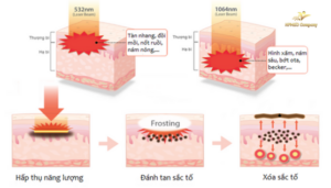 Thiet ke chua co ten 1 2
