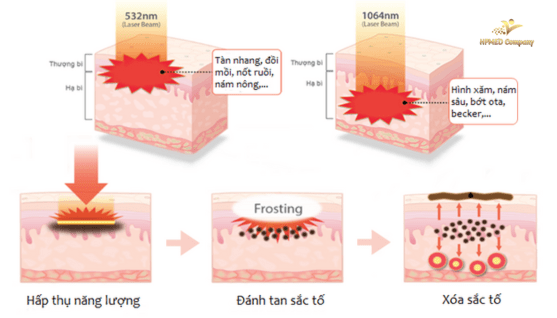 Thiet ke chua co ten 1 2