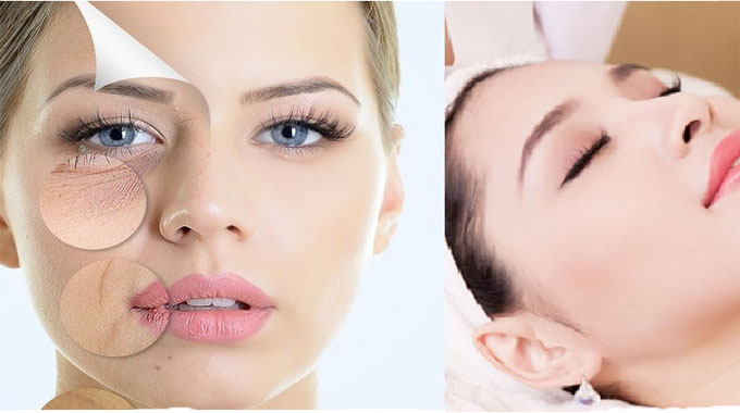 spa tri nam top 5 loi ich khi tri nam tai spa 672c4a9519a39