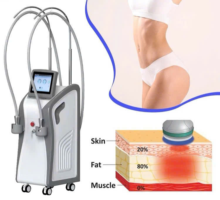 Cong Nghe Giam Beo Onda Coolwaves®