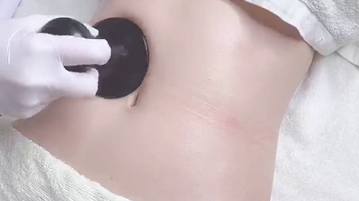 Cong Nghe Giam Beo RF