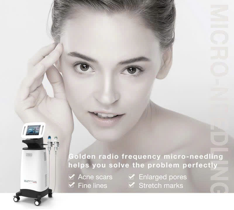 Máy Rf Vi Kim Quanstu - 08