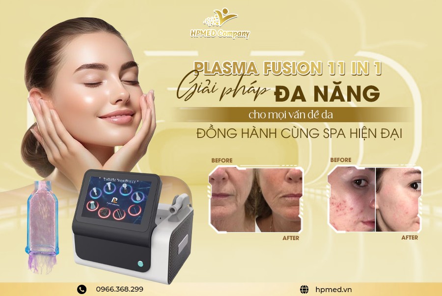 Máy Plasma Fusion 1 Máy Plasma Fusion