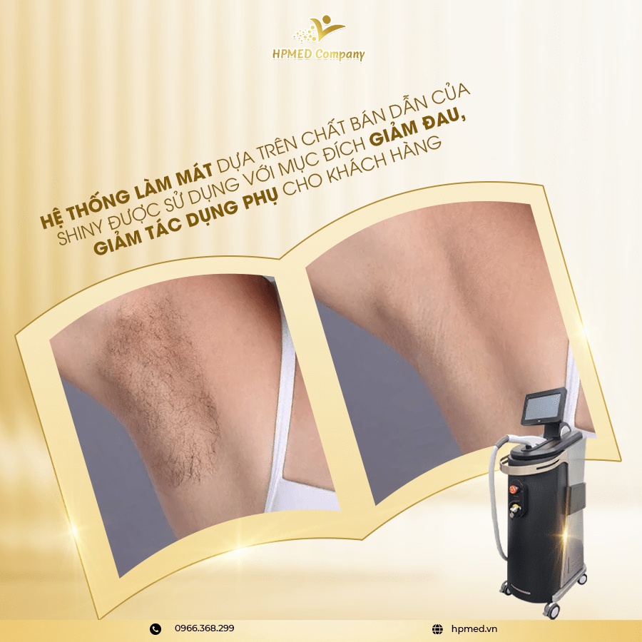 máy triệt lông shiny plus - 09