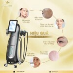 Máy RF Vi Điểm PatrixR - 04