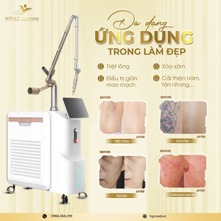 Máy Laser Pico Tech Premium - Sanhe - Bắc Kinh