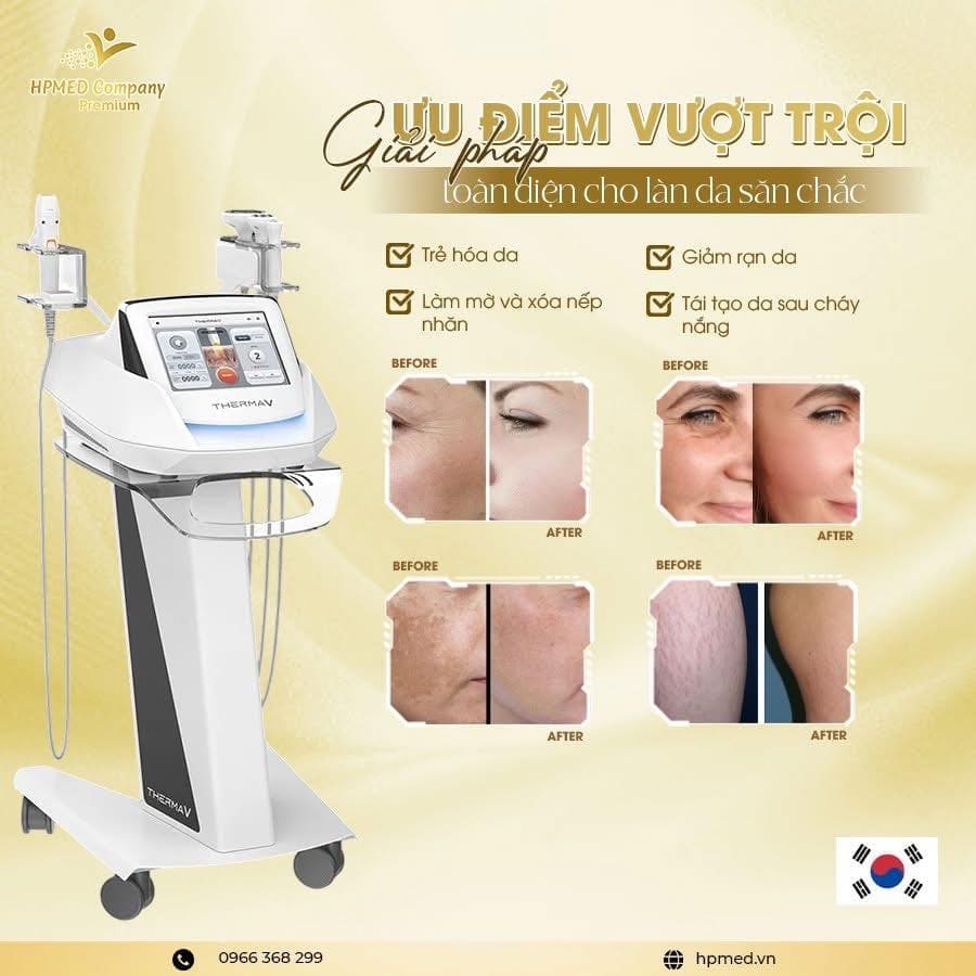 Máy Thermage V Hàn Quốc Cao Cấp
