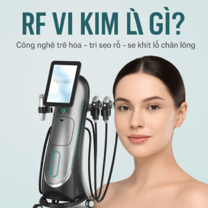 rf vi kim là gì